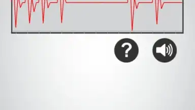 Captura de tela de Monitor Heart Rate 5