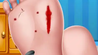 Captura de tela de Foot Surgery Doctor Care 1