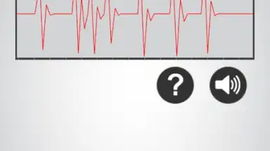 Captura de tela de Heart Rate Monitor 4