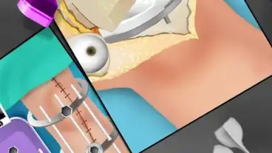 Captura de tela de KneeSurgery 1