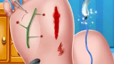Captura de tela de Foot Surgery Doctor Care 10