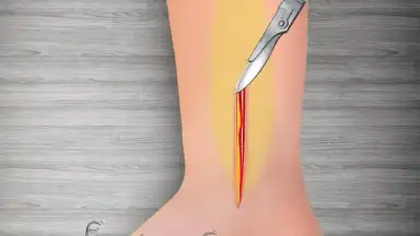 Captura de tela de WristSurgeryDoctor 3