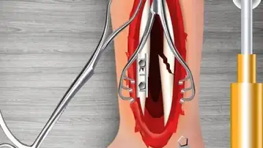 Captura de tela de WristSurgeryDoctor 9