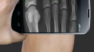 Captura de tela de X Ray Scanner Pro 1
