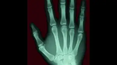 Captura de tela de Scanner X-ray 5