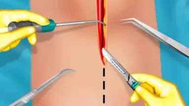 Captura de tela de KneeSurgery 2