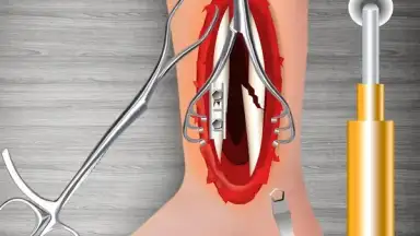 Captura de tela de WristSurgeryDoctor 2