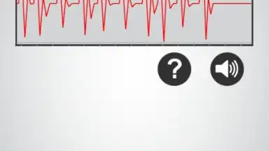 Captura de tela de Monitor Heart Rate 3