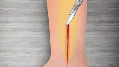 Captura de tela de WristSurgeryDoctor 16