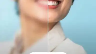 Captura de tela de Remini 10