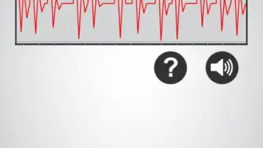 Captura de tela de Monitor Heart Rate 1